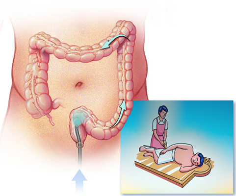 Colon Basti · The Inner Cleanse